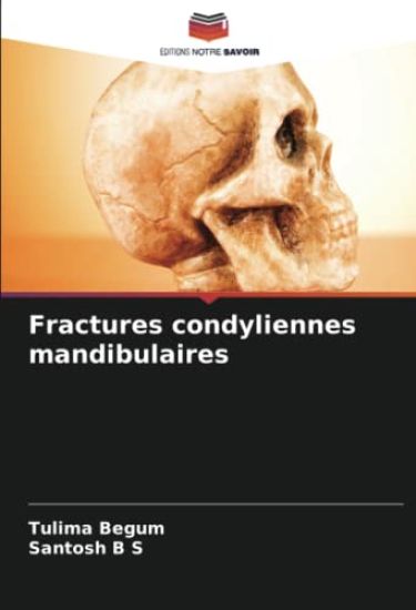 Fractures condyliennes mandibulaires