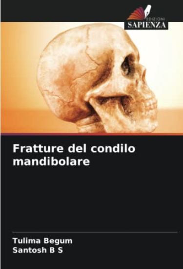 Fratture del condilo mandibolare
