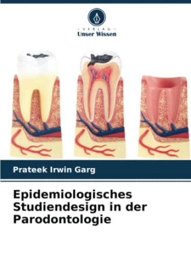 Epidemiologisches Studiendesign in der Parodontologie