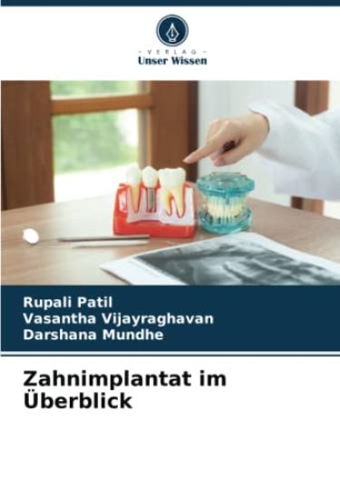 Zahnimplantat im Überblick