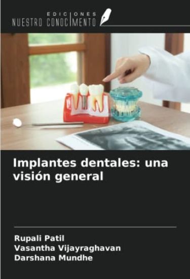 Implantes dentales: una visión general