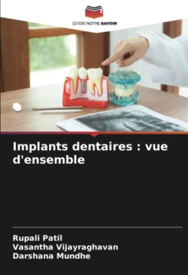 Implants dentaires : vue d'ensemble