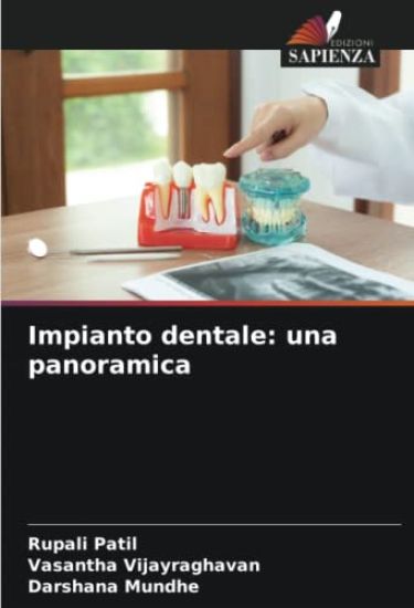 Impianto dentale: una panoramica