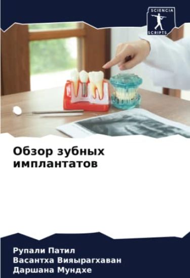 Obzor zubnyh implantatow