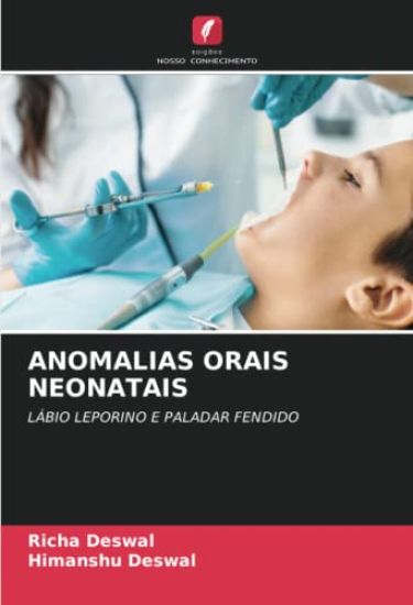 ANOMALIAS ORAIS NEONATAIS