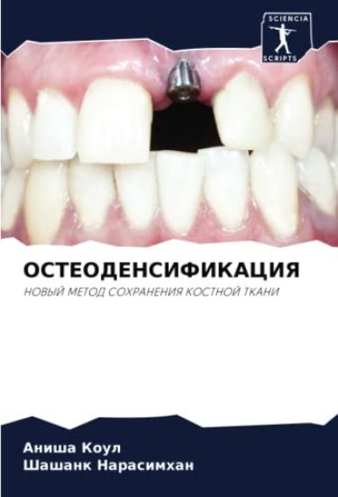 OSTEODENSIFIKACIYa