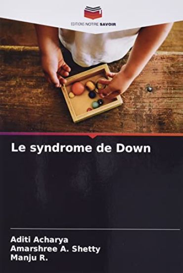 Le syndrome de Down