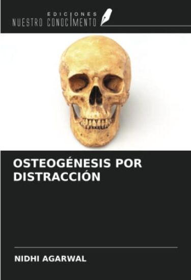 OSTEOGÉNESIS POR DISTRACCIÓN – Nidhi Agarwal, kirjan kansikuva
