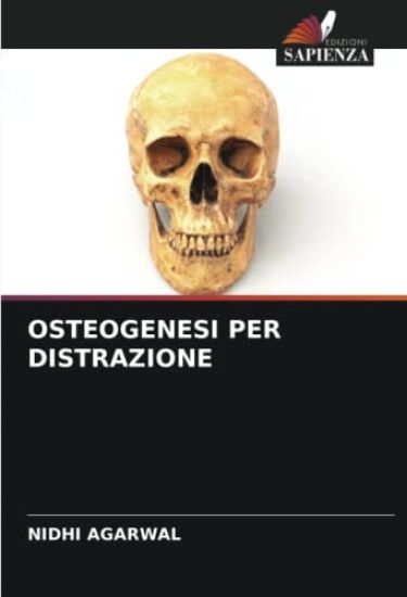 OSTEOGENESI PER DISTRAZIONE – Nidhi Agarwal, kirjan kansikuva