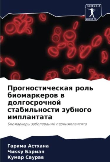 Prognosticheskaq rol' biomarkerow w dolgosrochnoj stabil'nosti zubnogo implantata