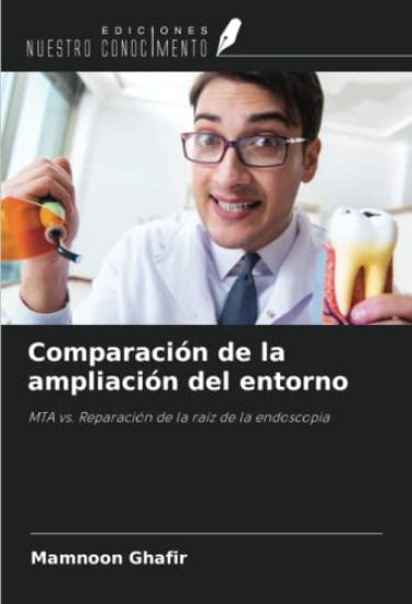 Comparación de la ampliación del entorno