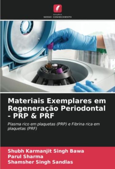 Materiais Exemplares em Regeneração Periodontal - PRP & PRF