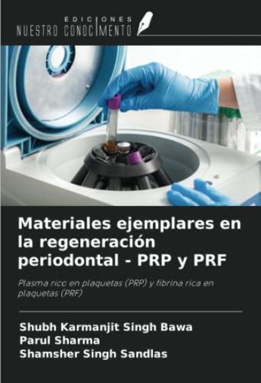 Materiales ejemplares en la regeneración periodontal - PRP y PRF