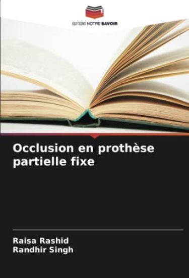 Occlusion en prothèse partielle fixe