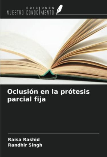 Oclusión en la prótesis parcial fija