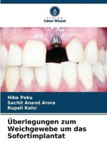 Überlegungen zum Weichgewebe um das Sofortimplantat – Hiba Peku, kirjan kansikuva