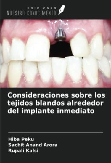 Consideraciones sobre los tejidos blandos alrededor del implante inmediato
