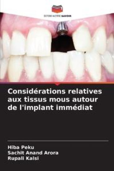 Considérations relatives aux tissus mous autour de l'implant immédiat – Hiba Peku, kirjan kansikuva