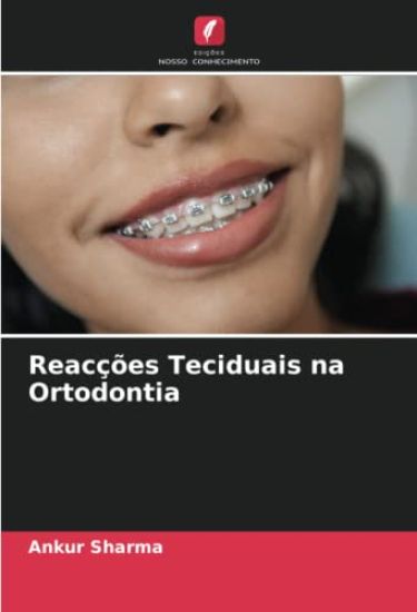 Reacções Teciduais na Ortodontia