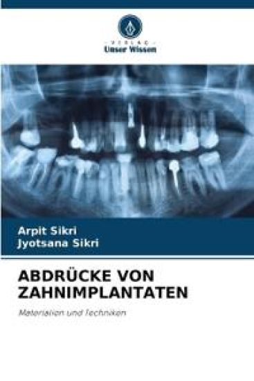Abdrücke Von Zahnimplantaten – Arpit Sikri, kirjan kansikuva