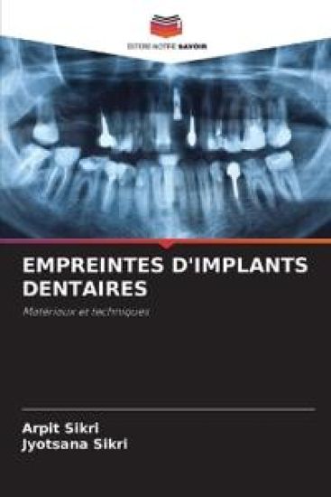 Empreintes d'Implants Dentaires – Arpit Sikri, kirjan kansikuva