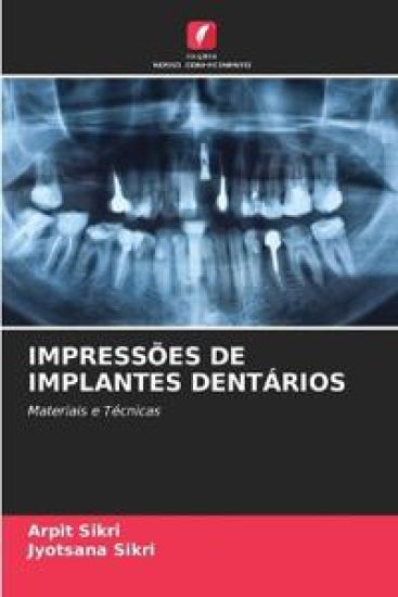 Impressões de Implantes Dentários – Arpit Sikri, kirjan kansikuva