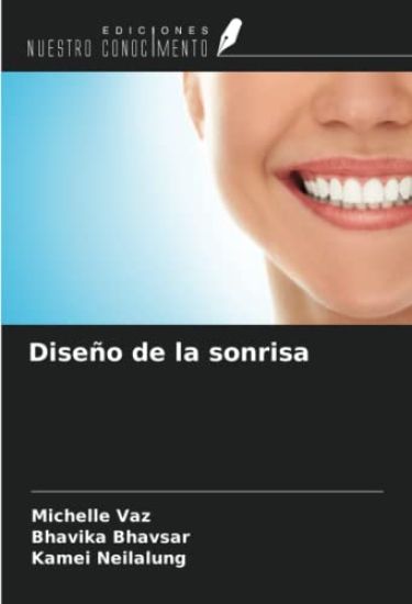 Diseño de la sonrisa