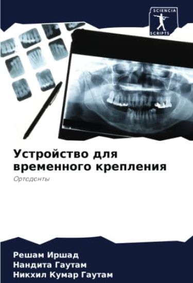 Ustrojstwo dlq wremennogo krepleniq