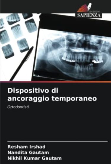 Dispositivo di ancoraggio temporaneo