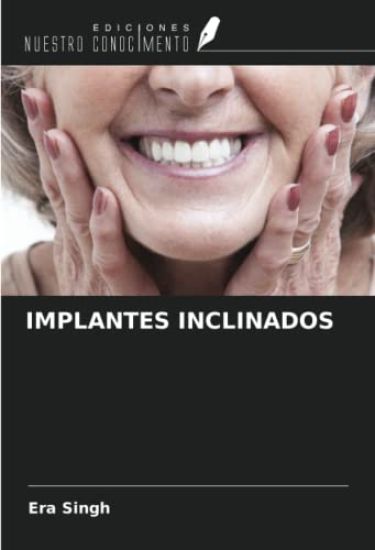IMPLANTES INCLINADOS