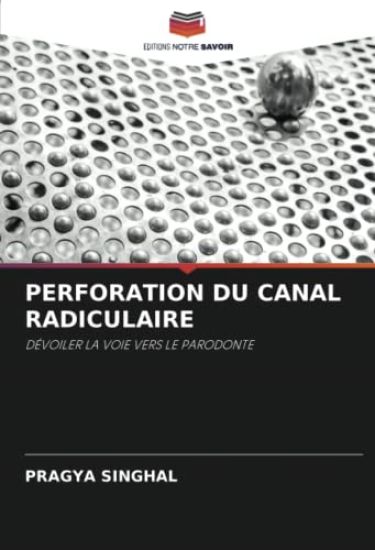 PERFORATION DU CANAL RADICULAIRE