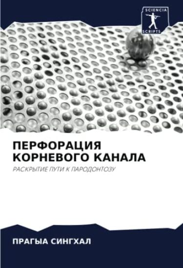 PERFORACIYa KORNEVOGO KANALA