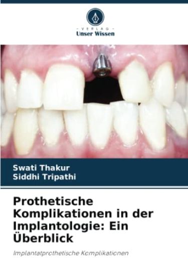 Prothetische Komplikationen in der Implantologie: Ein Überblick