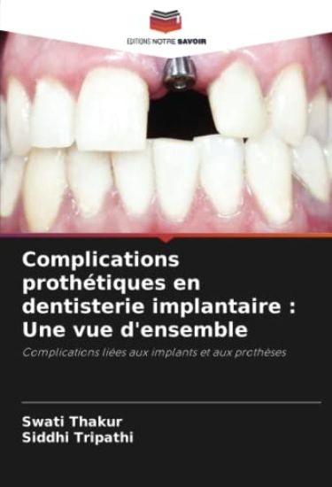 Complications prothétiques en dentisterie implantaire : Une vue d'ensemble