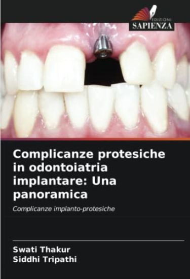Complicanze protesiche in odontoiatria implantare: Una panoramica