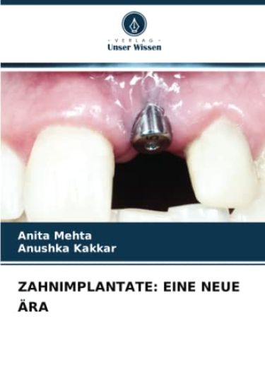 ZAHNIMPLANTATE: EINE NEUE ÄRA