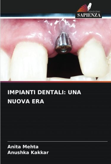 IMPIANTI DENTALI: UNA NUOVA ERA