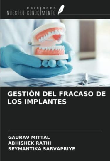 GESTIÓN DEL FRACASO DE LOS IMPLANTES