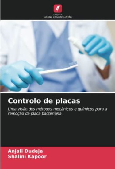Controlo de placas