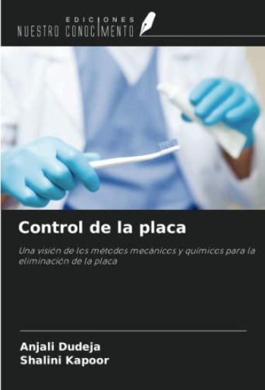 Control de la placa