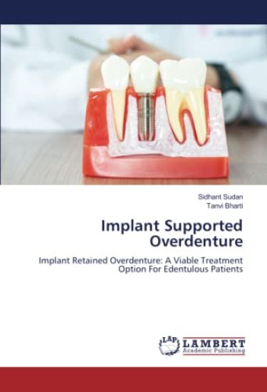 Implant Supported Overdenture