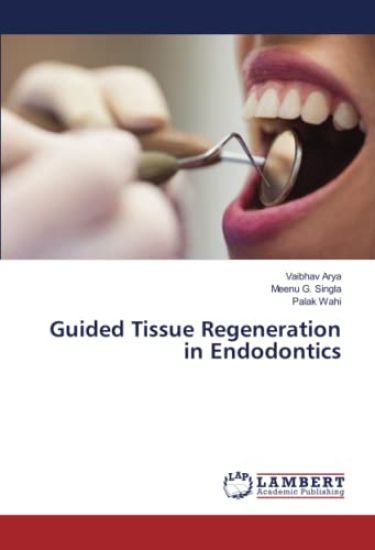 Guided Tissue Regeneration in Endodontics
