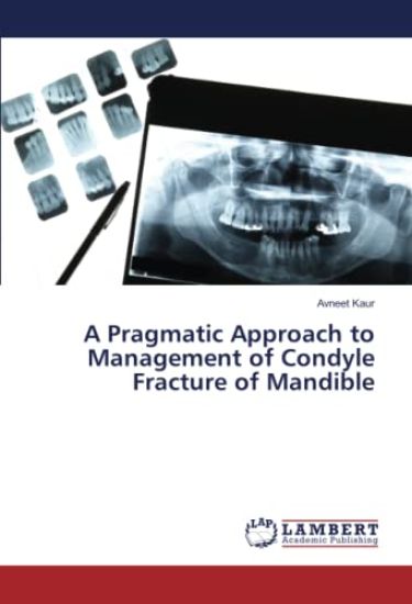 A Pragmatic Approach to Management of Condyle Fracture of Mandible – Avneet Kaur, kirjan kansikuva