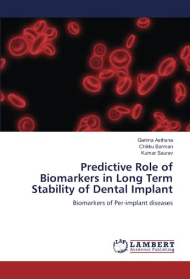 Predictive Role of Biomarkers in Long Term Stability of Dental Implant