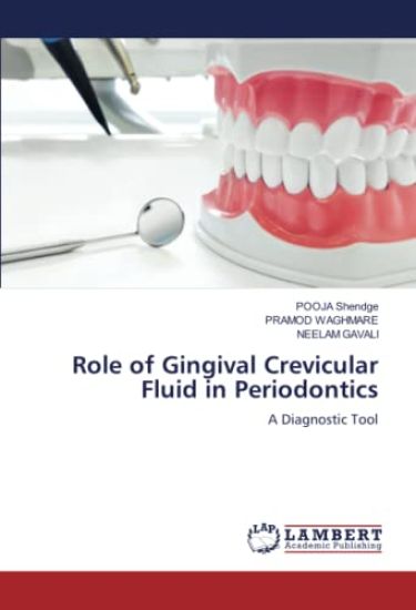 Role of Gingival Crevicular Fluid in Periodontics