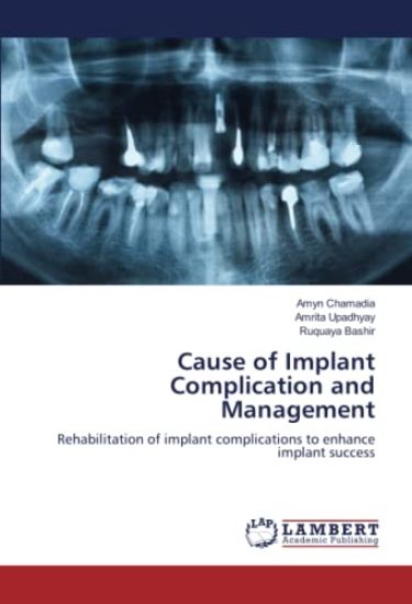 Cause of Implant Complication and Management