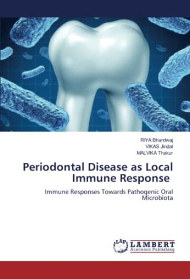 Periodontal Disease as Local Immune Response