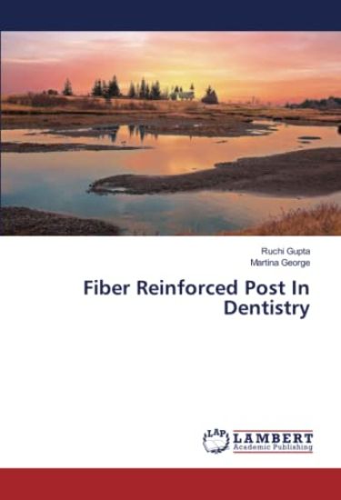 Fiber Reinforced Post In Dentistry