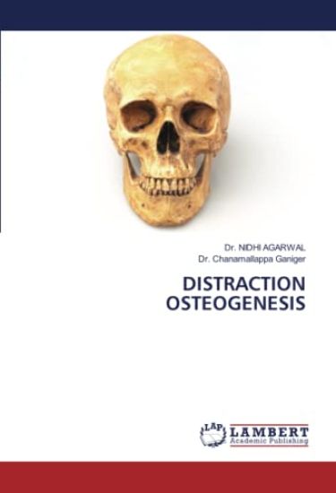 DISTRACTION OSTEOGENESIS – Nidhi Agarwal, kirjan kansikuva