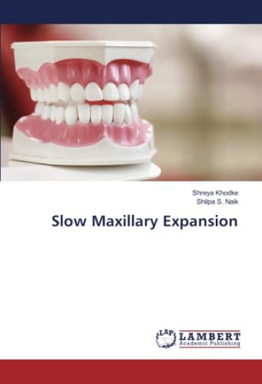 Slow Maxillary Expansion
